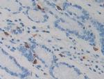 Resistin Monoclonal Antibody (D2)