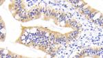RBP2 Antibody in Immunohistochemistry (Paraffin) (IHC (P))
