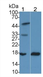RBP2 Antibody in Western Blot (WB)