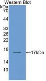 RBP2 Antibody in Western Blot (WB)