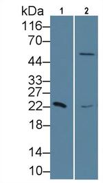 RBP4 Antibody in Western Blot (WB)