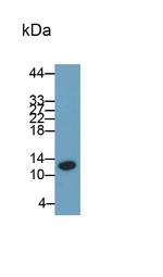 S100A8 Antibody in Western Blot (WB)