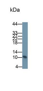 S100A8 Antibody in Western Blot (WB)