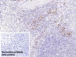 S100A9 Monoclonal Antibody (H2)