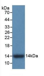 S100A9 Antibody in Western Blot (WB)
