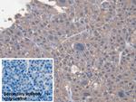SAA Antibody in Immunohistochemistry (Paraffin) (IHC (P))