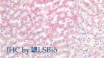 SAA Antibody in Immunohistochemistry (Paraffin) (IHC (P))