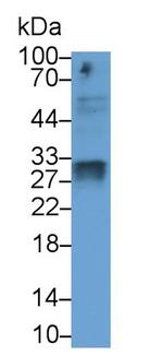 SOD3 Monoclonal Antibody (C1)