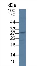 TK1 Antibody in Western Blot (WB)