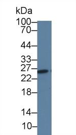 TK1 Antibody in Western Blot (WB)
