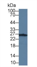 TK1 Antibody in Western Blot (WB)