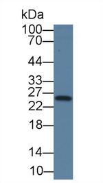 TK1 Antibody in Western Blot (WB)