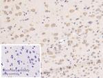 TFPI Antibody in Immunohistochemistry (Paraffin) (IHC (P))