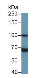 TLR5 Antibody in Western Blot (WB)