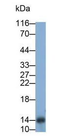 TFF2 Antibody in Western Blot (WB)