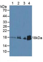 Cardiac Troponin I Antibody in Western Blot (WB)