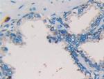 Tryptase Antibody in Immunohistochemistry (Paraffin) (IHC (P))