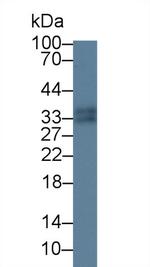 Tryptase Antibody in Western Blot (WB)