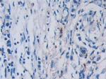 Tryptase Antibody in Immunohistochemistry (Paraffin) (IHC (P))