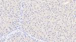 TDO2 Antibody in Immunohistochemistry (Paraffin) (IHC (P))