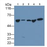GC Antibody in Western Blot (WB)