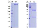 Alemtuzumab Humanized Antibody in SDS-PAGE (SDS-PAGE)