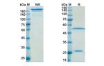 Efalizumab Humanized Recombinant Human Monoclonal Antibody