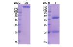 Epratuzumab Humanized Antibody in SDS-PAGE (SDS-PAGE)