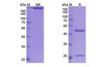 Fontolizumab Humanized Recombinant Human Monoclonal Antibody