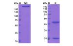 Cantuzumab Humanized Recombinant Human Monoclonal Antibody