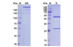 Labetuzumab Humanized Antibody in SDS-PAGE (SDS-PAGE)
