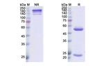 Amatuximab Chimeric Antibody in SDS-PAGE (SDS-PAGE)