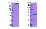 CD2 (Siplizumab Biosimilar) Antibody in SDS-PAGE (SDS-PAGE)
