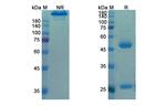 Motavizumab Humanized Antibody in SDS-PAGE (SDS-PAGE)