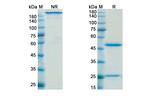 Nimotuzumab Humanized Recombinant Human Monoclonal Antibody