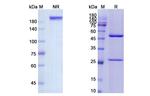CD4 (Cedelizumab Biosimilar) Recombinant Humanized mouse Monoclonal Antibody