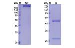 Palivizumab Humanized Antibody in SDS-PAGE (SDS-PAGE)