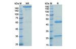 Her-2 (ErbB2) (Pertuzumab Biosimilar) Antibody in SDS-PAGE (SDS-PAGE)