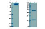 Sevirumab Humanized Recombinant Human Monoclonal Antibody