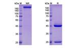 Felvizumab Humanized Recombinant Human Monoclonal Antibody