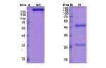 Mepolizumab Humanized Recombinant Human Monoclonal Antibody