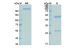 Pascolizumab Humanized Recombinant Human Monoclonal Antibody