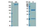 Foravirumab Humanized Antibody in SDS-PAGE (SDS-PAGE)
