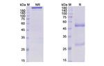 Rafivirumab Humanized Antibody in SDS-PAGE (SDS-PAGE)