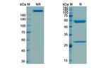Visilizumab Humanized Recombinant Human Monoclonal Antibody