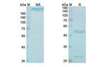 IL-1 beta (Gevokizumab Biosimilar) Antibody in SDS-PAGE (SDS-PAGE)