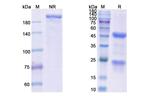 14F7 Recombinant Mouse Monoclonal Antibody