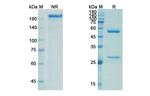 4F2Mab Humanized Recombinant Human Monoclonal Antibody