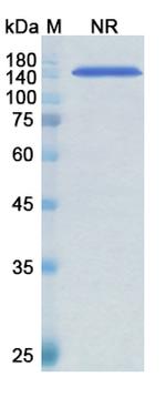 Arcitumomab Antibody in SDS-PAGE (SDS-PAGE)