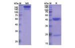 Capromab Antibody in SDS-PAGE (SDS-PAGE)